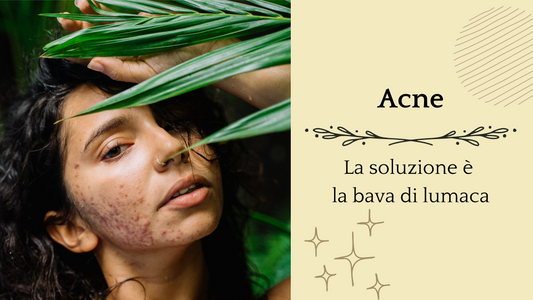 Bava di Lumaca e Acne: La Soluzione Naturale per una Pelle Chiara