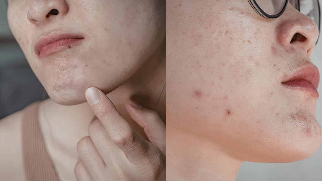 Siero Viso Uniformante alla Bava di Lumaca Bio e Acido Azelaico: pelle più liscia, luminosa e senza imperfezioni